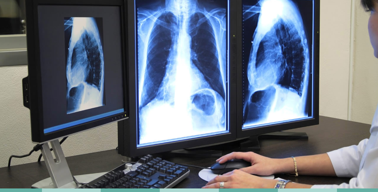 medico viendo radiografías de persona